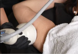 Illustrative placement: Upper Arm Firming