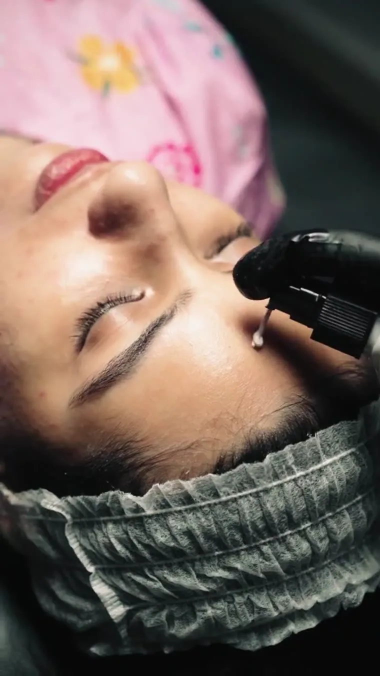 Illustrative placement: Chemical Peels