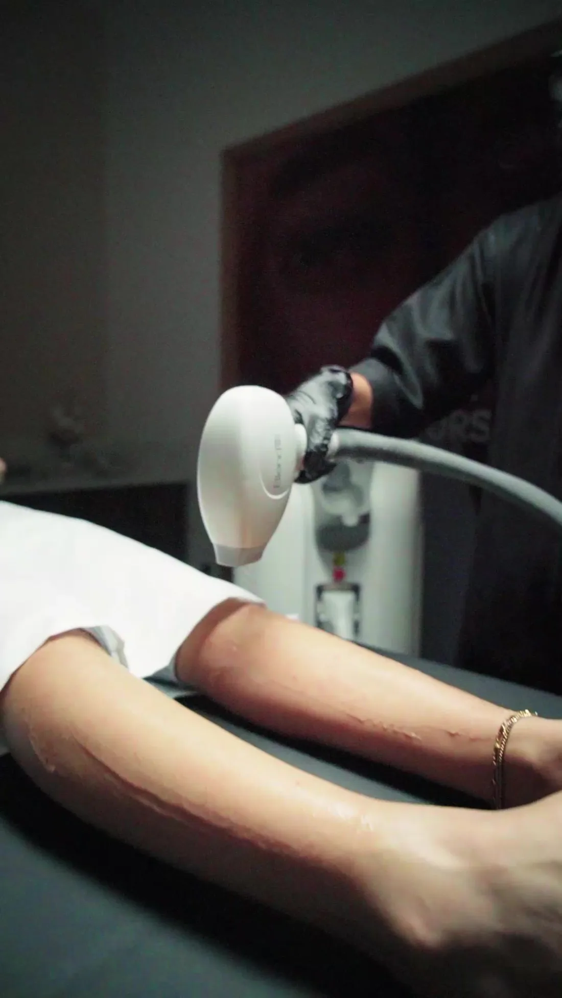 Illustrative placement: Carbon Laser Facial